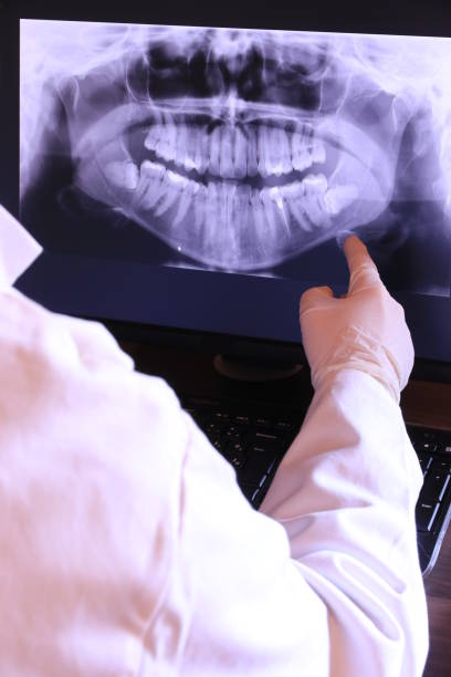 Best Emergency Root Canal Treatment in Port Orchard, WA
